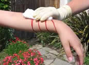 cuts and grazes